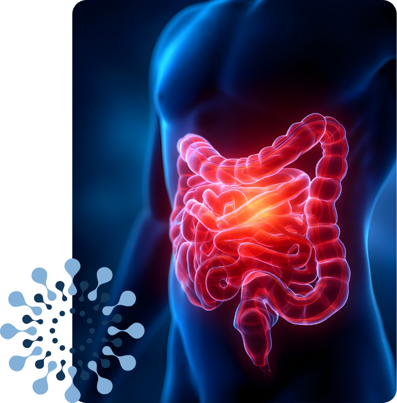 Tipos de Câncer - Câncer colorretal