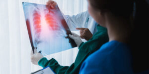 Sintomas, diagnóstico e achado de nódulo pulmonar: quando se preocupar?