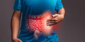 Câncer colorretal em jovens: está mesmo aumentando?