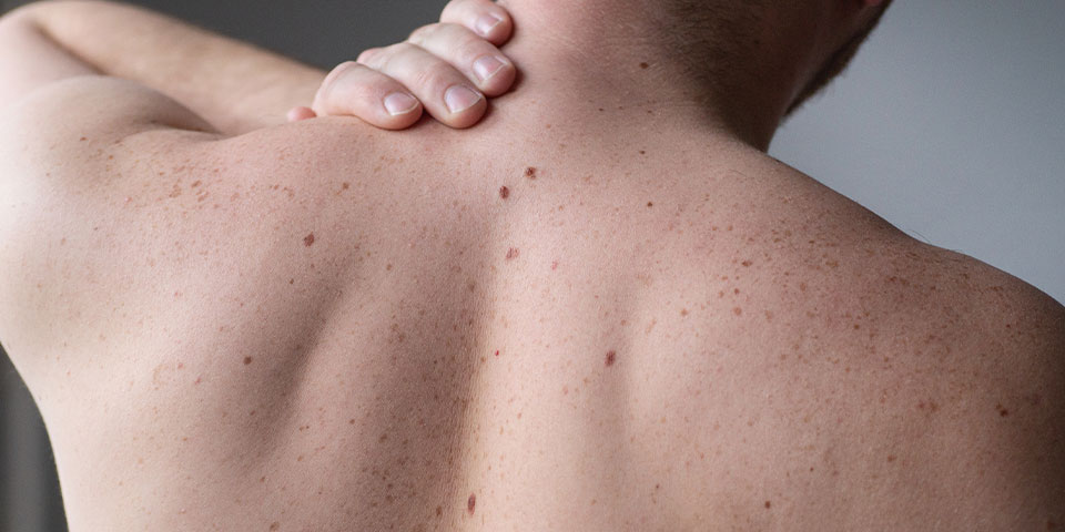 Pintas, lesões e feridas que não cicatrizam: quando devo me preocupar?